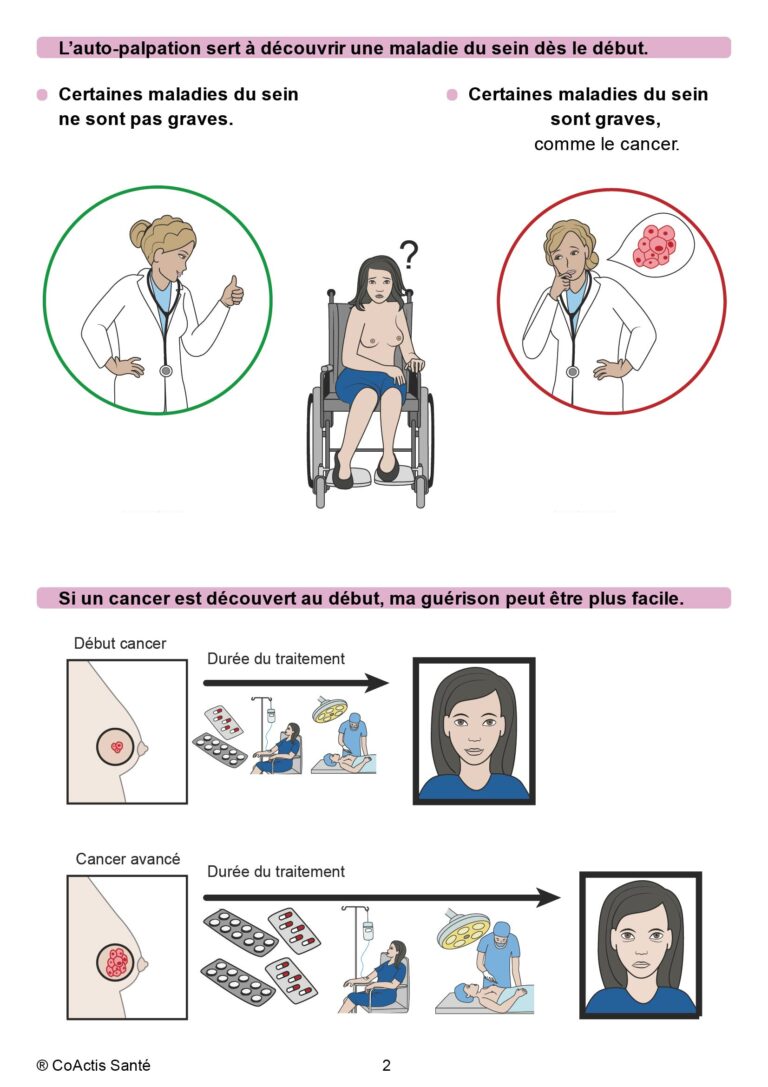 03-Sert_a_découvrir-une-maladi-du-sein-au-début